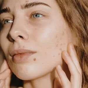 Skincare products for breakouts & clarifying to support clearer skin while maintaining hydration and comfort